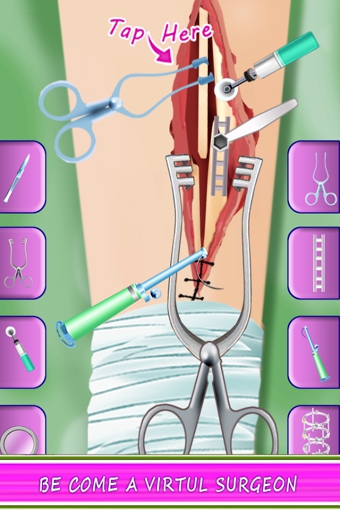 腿部外科醫(yī)生 v1.6 安卓版圖1