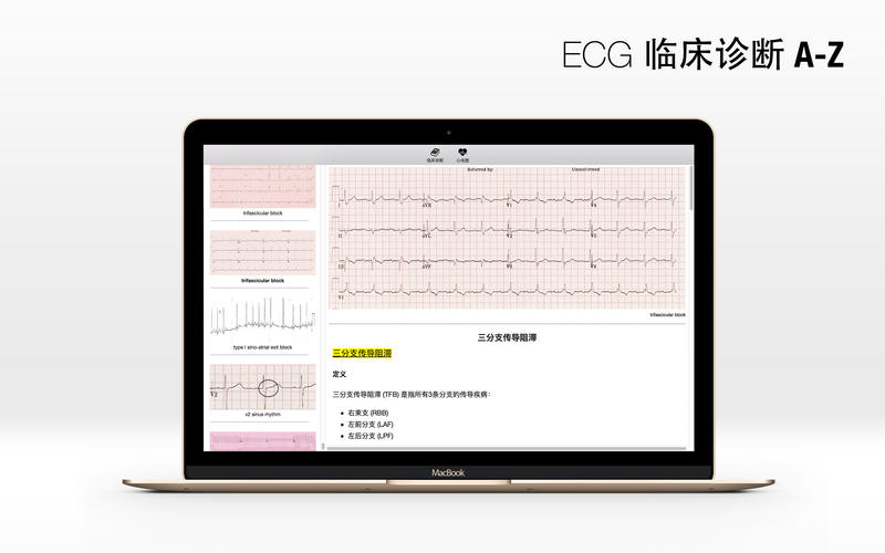 ECG Mac版