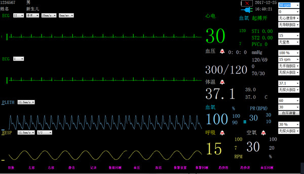 新生兒監(jiān)護儀軟件